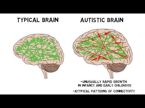 2-Minute Neuroscience: Autism