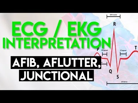 ECG EKG Heart Rhythms Nursing #shorts (afib vtach bradycardia sinus ...