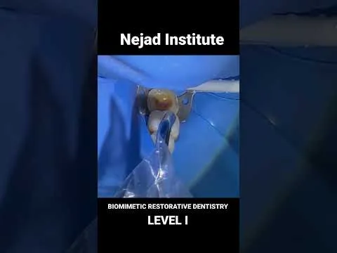 biomimetic-dentistry-level-i-course-nejad-institute-5180