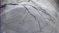 coronary-angiography-with-mcqs-and-notes-11012