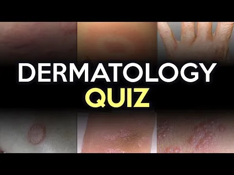 dermatology-quiz-5204