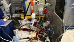 ecmo-in-hospital-and-transport-6124