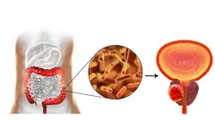 Gut Health And Microbiome