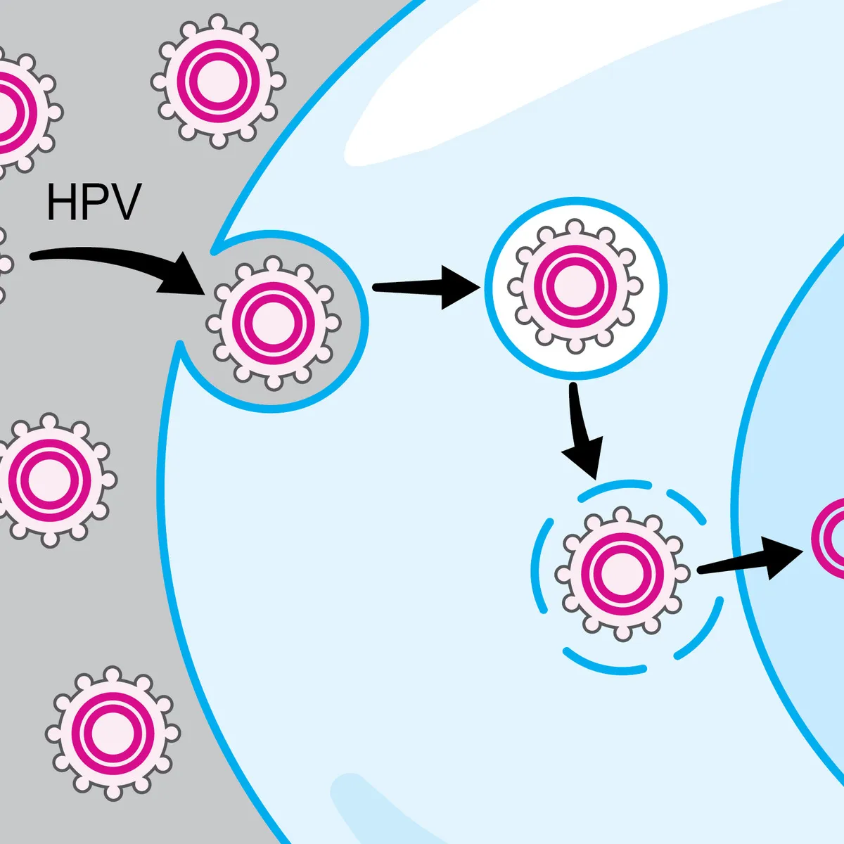 hpv-associated-oral-and-throat-cancer-what-you-need-to-know-2047