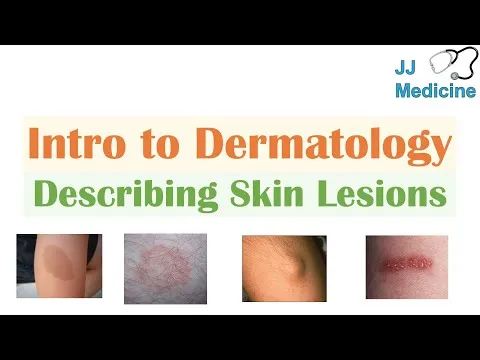 introduction-to-dermatology-the-basics-describing-skin-lesions-primary-secondary-morphology-5199