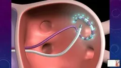 master-cardiac-electrophysiology-2-with-mcqs-evaluation-3089