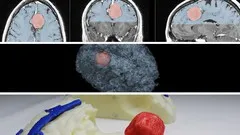 medical-imaging-3d-modelling-and-3d-printing-beginners-11011