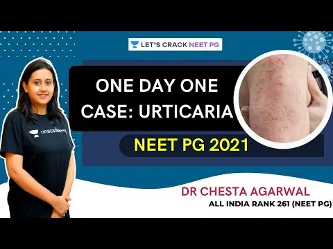 one-day-one-case-series-urticaria-dermatology-neet-pg-2021-dr-chesta-agarwal-5198