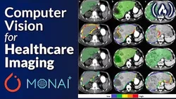 pytorch-and-monai-for-ai-healthcare-imaging-python-machine-learning-course-13970