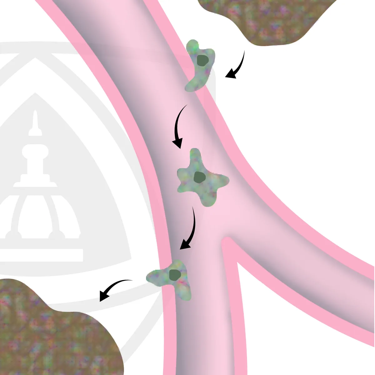 Understanding Cancer Metastasis